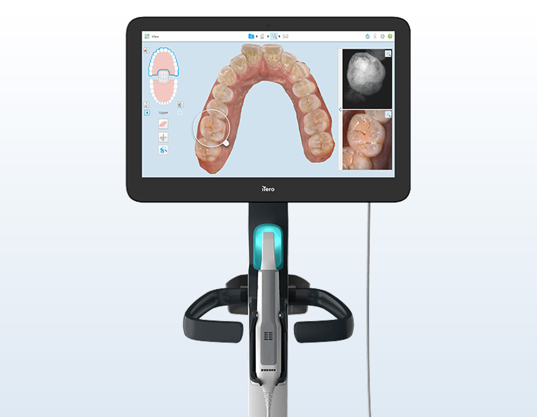 日野Life歯科・矯正歯科の設備紹介画像：iTero（アイテロ／3D口腔内スキャナー）